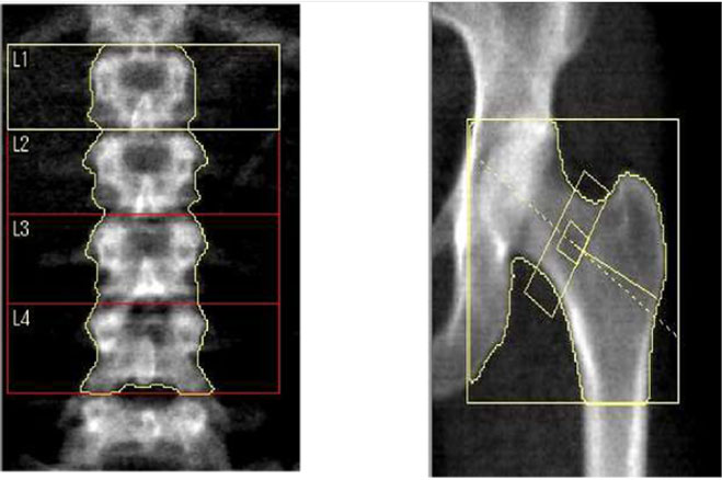 inspection_bone_01.jpg