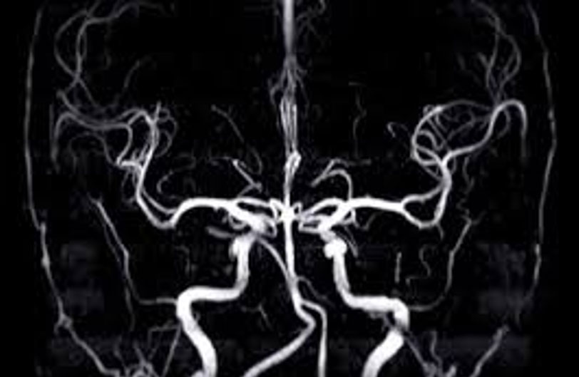 inspection_brain_01.jpg