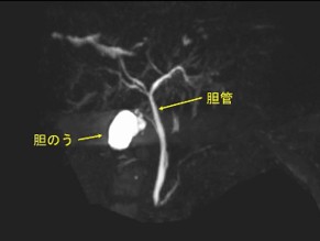 inspection_pancreas_01.jpg