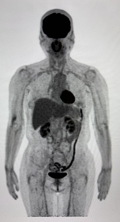 inspection_petct_01.jpg