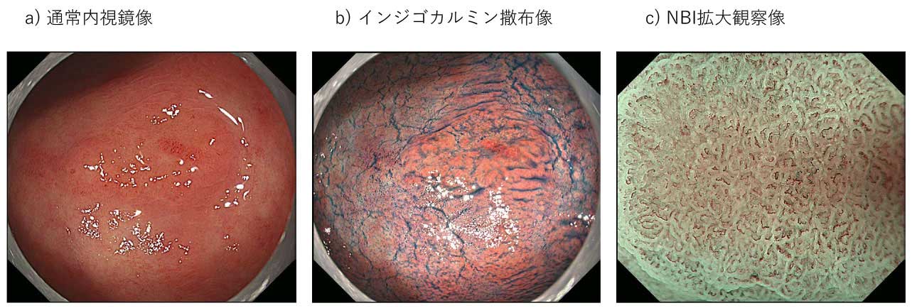 gastrointestinal_cancer_2_m.jpg