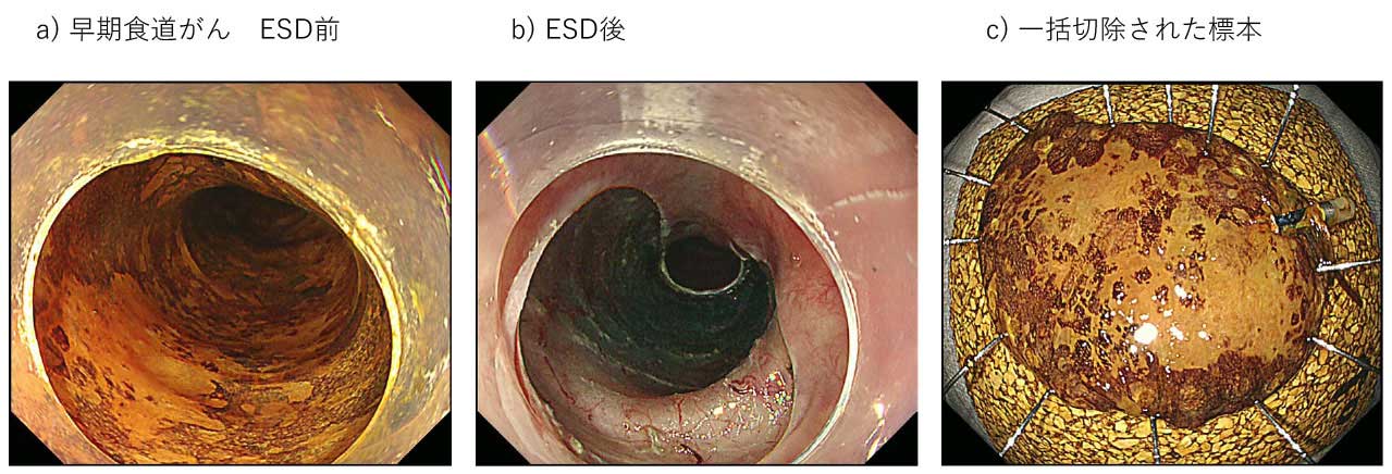 gastrointestinal_cancer_5_m.jpg